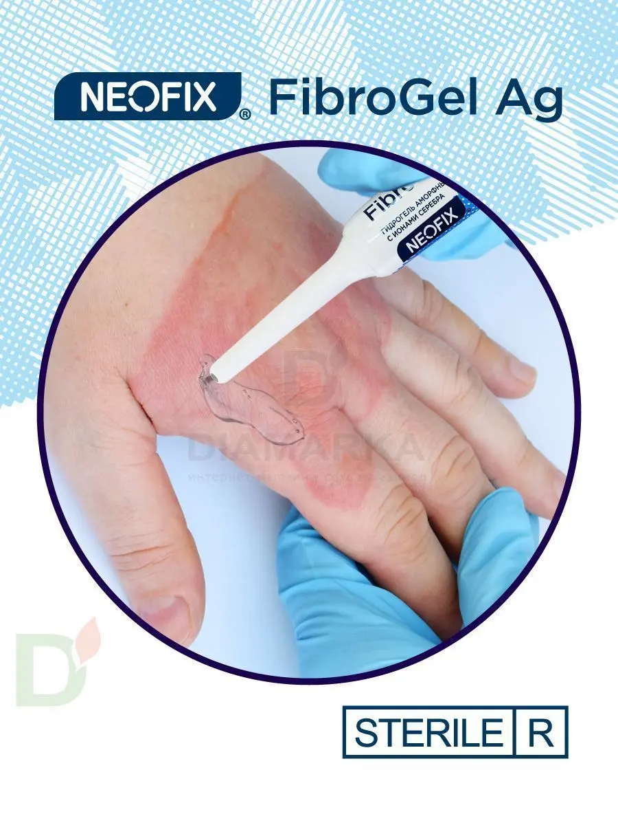 Гидрогель антимикробный NEOFIX FibroGel Fg с ионами серебра 15г в Туле